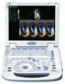 Ecografo portatile Fukuda UF760AG