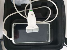 Mysonics smart ultrasound